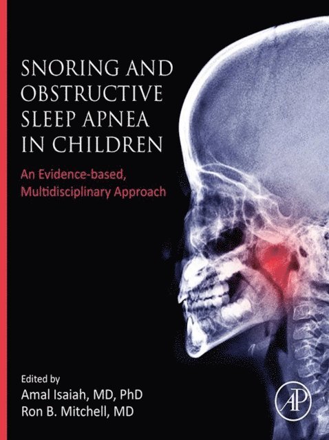 Ron B. Mitchell, Amal Isaiah - Snoring and Obstructive Sleep Apnea in Children, E-bok. Tillgänglighet: Lägg i varukorg