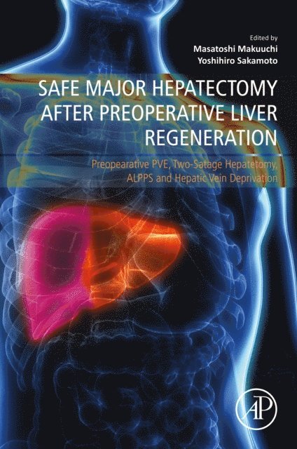 Masatoshi Makuuchi, Yoshihiro Sakamoto - Safe Major Hepatectomy after Preoperative Liver Regeneration, E-bok