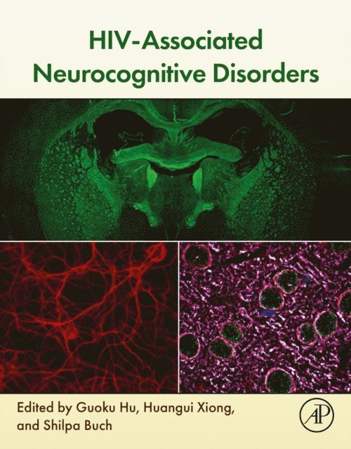 Shilpa Buch, Huangui Xiong, Guoku Hu - HIV-Associated Neurocognitive Disorders, E-bok