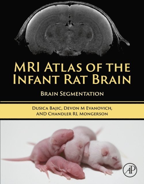 Chandler Mongerson, Devon Evanovich, Dusica Bajic - MRI Atlas of the Infant Rat Brain, E-bok