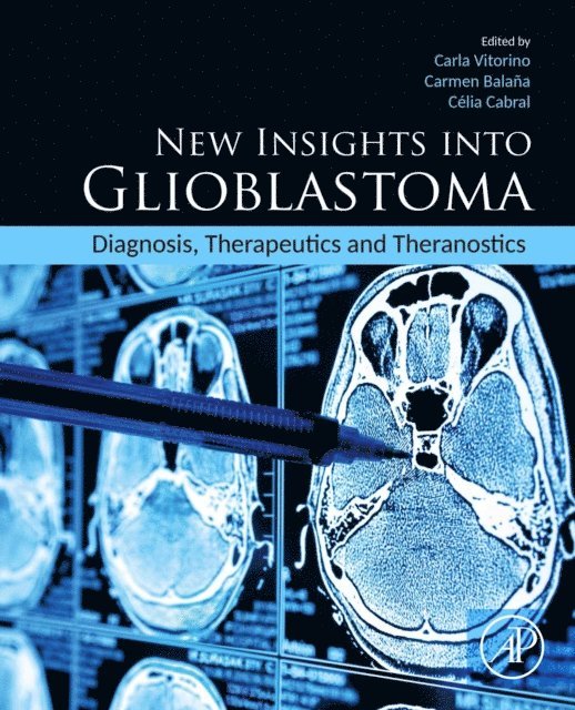 Celia Cabral, Carmen Balana, Carla Vitorino - New Insights into Glioblastoma, E-bok. Tillgänglighet: Lägg i varukorg