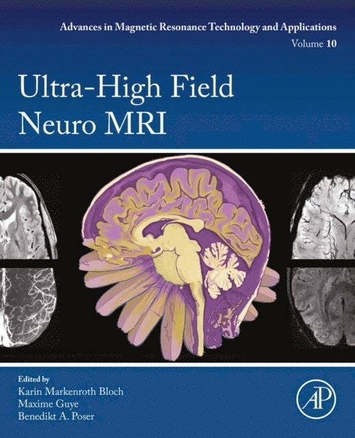 Benedikt A. Poser, Maxime Guye, Karin Markenroth Bloch - Ultra-High Field Neuro MRI, E-bok