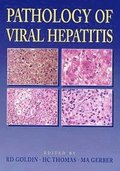 Pathology of Viral Hepatitis