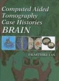 Computed Aided Tomography Case Histories Of The Brain