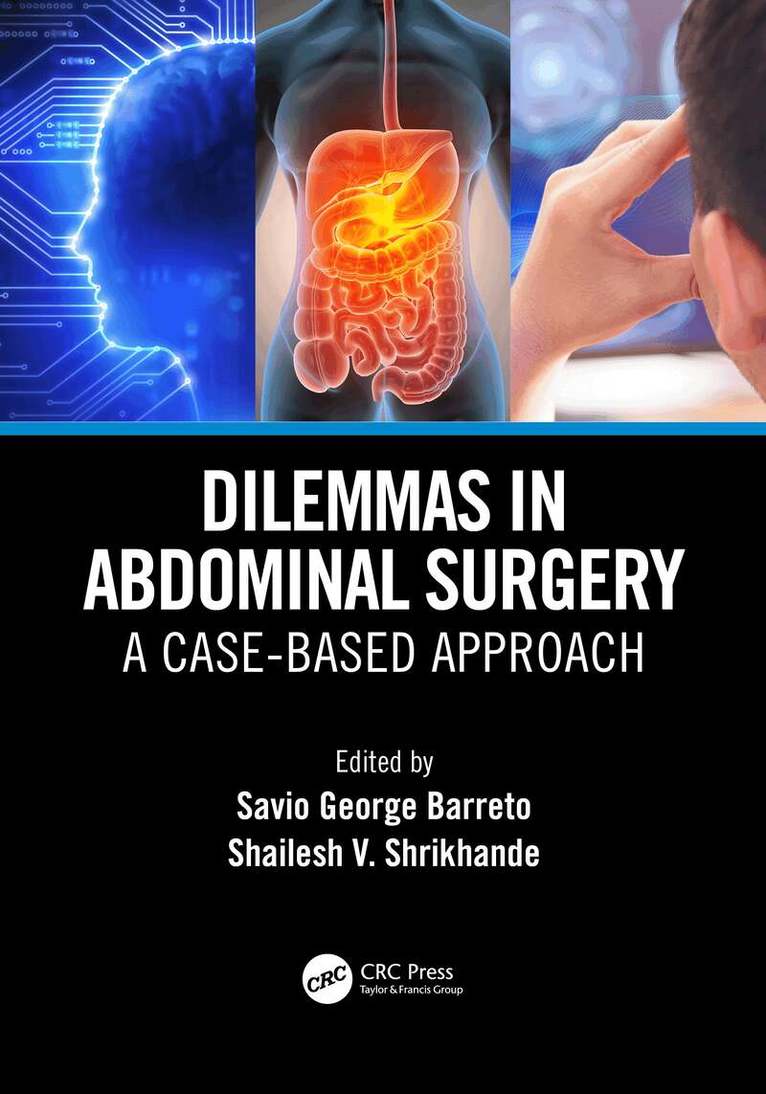 Savio George Alberto da Piedade Barreto, Shailesh Vinayak Shrikhande - Dilemmas in Abdominal Surgery, Häftad