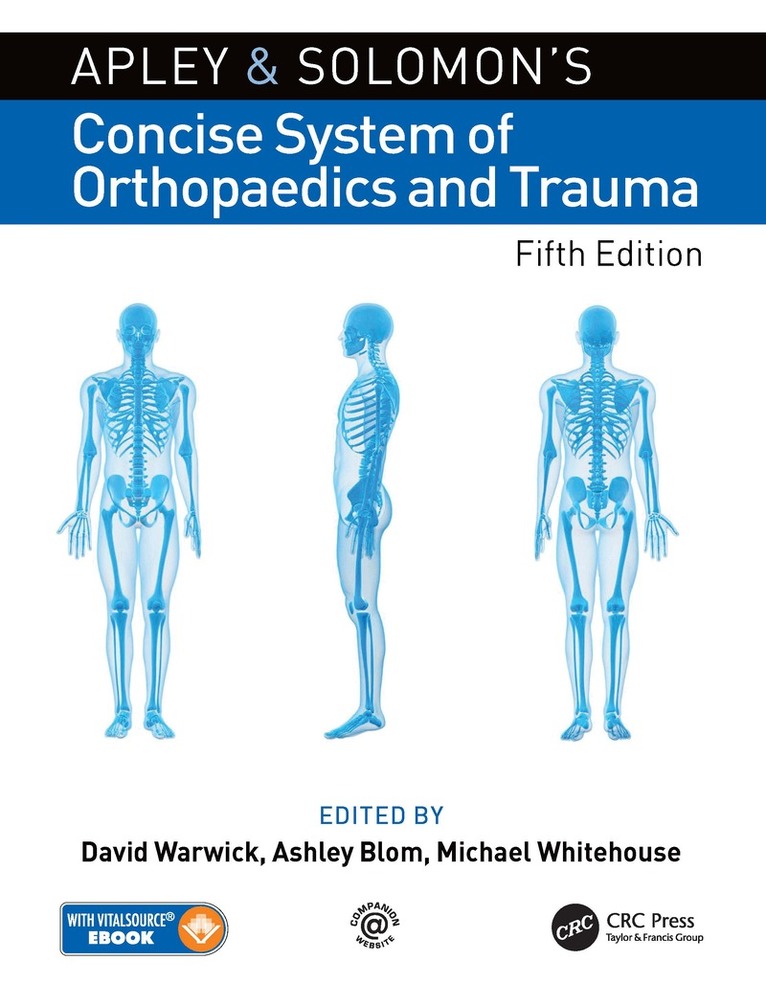 David Warwick, Ashley Blom, Michael Whitehouse - Apley and Solomon’s Concise System of Orthopaedics and Trauma, Inbunden