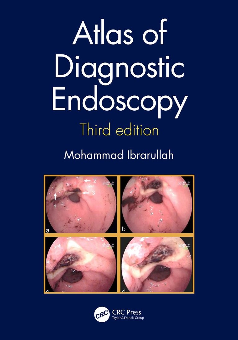 Mohammad Ibrarullah - Atlas of Diagnostic Endoscopy, 3E, Inbunden