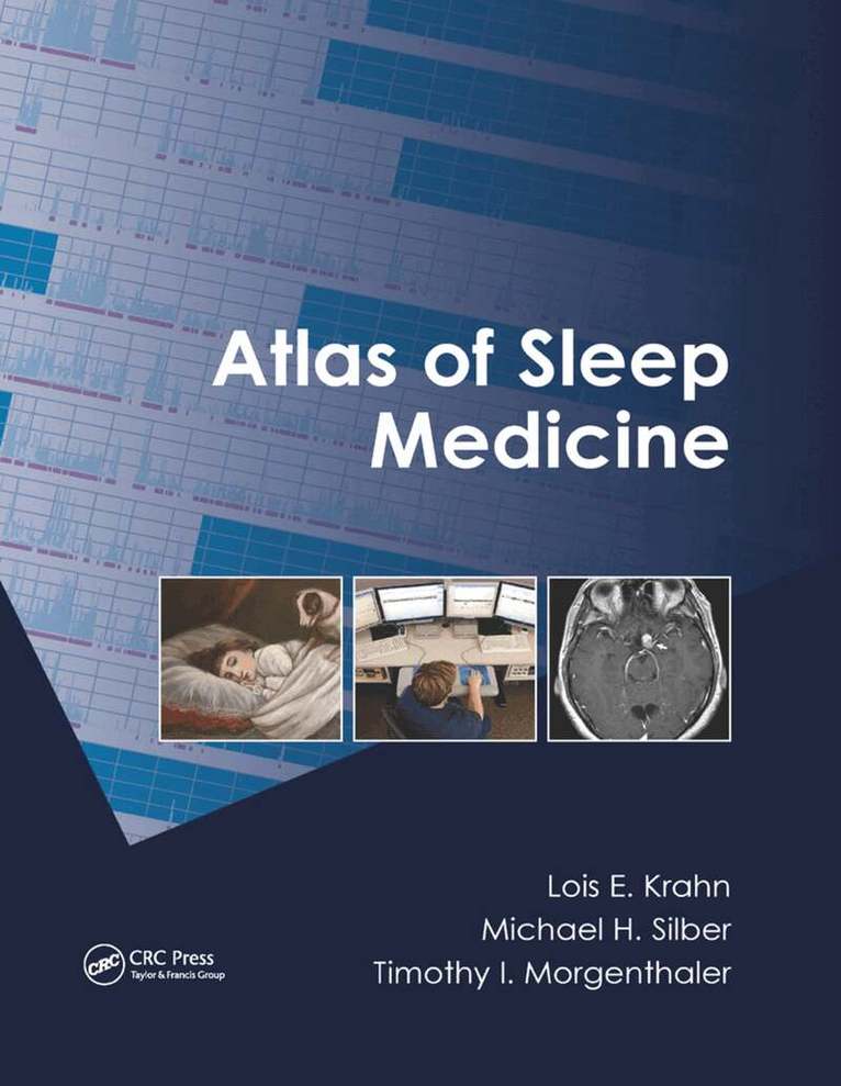 Lois E. Krahn, Michael H. Silber, Timothy I. Morgenthaler - Atlas of Sleep Medicine, Häftad. Tillgänglighet: Lägg i varukorg