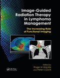 Image-Guided Radiation Therapy in Lymphoma Management