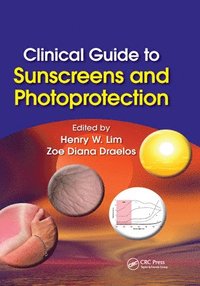 Clinical Guide to Sunscreens and Photoprotection