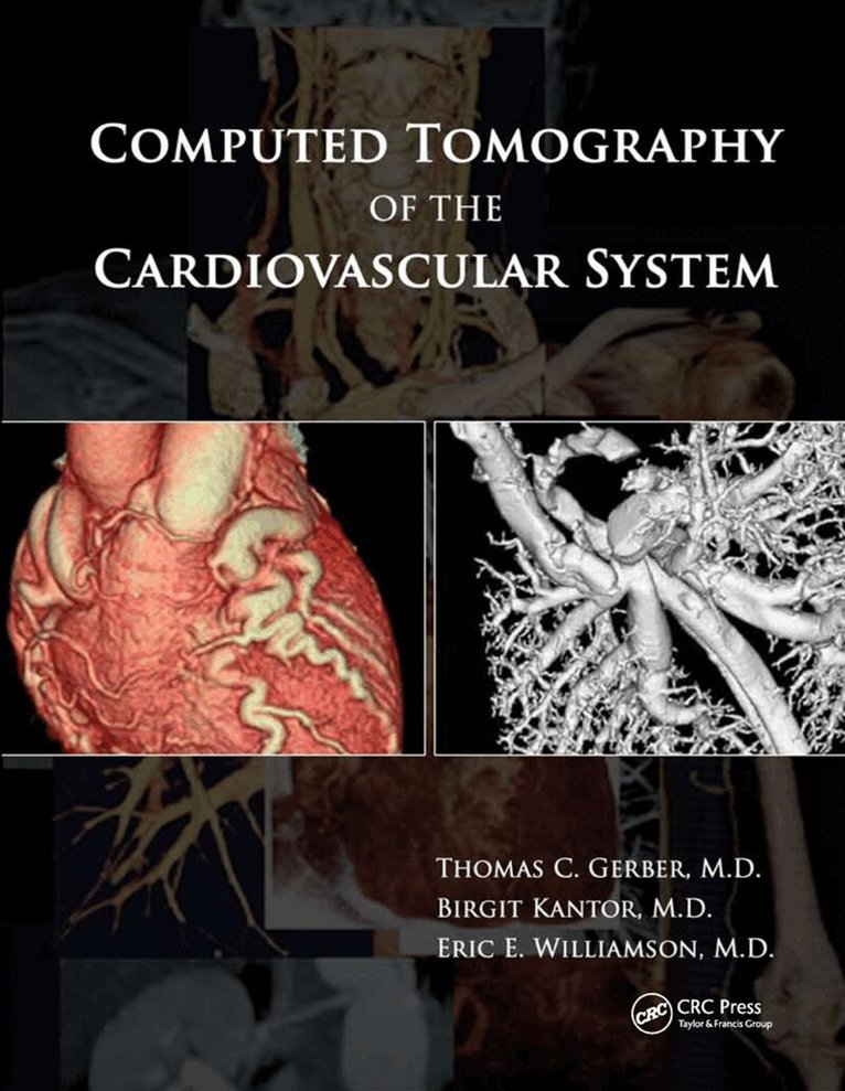 Thomas C. Gerber, Birgit Kantor, Eric E. Williamson - Computed Tomography of the Cardiovascular System, Häftad