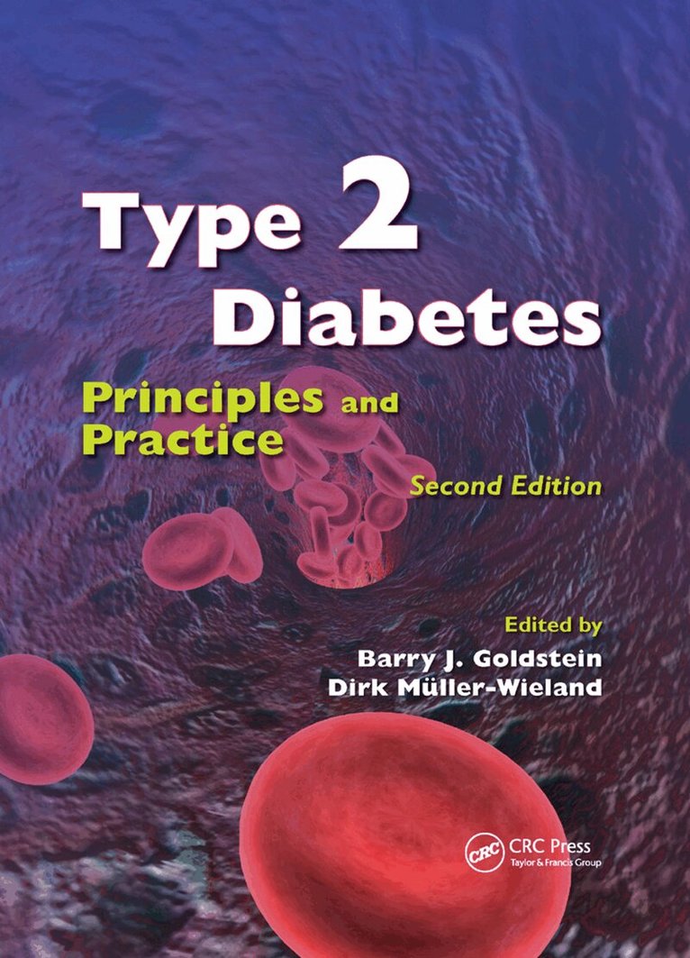 Barry J. Goldstein, Dirk Mueller-Wieland - Type 2 Diabetes, Häftad