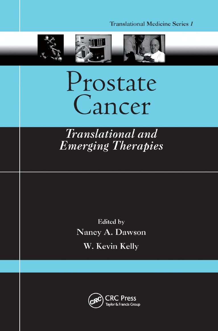 Nancy A. Dawson, W. Kevin Kelly - Prostate Cancer, Häftad