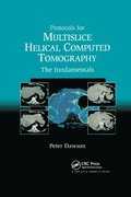 Protocols for Multislice Helical Computed Tomography