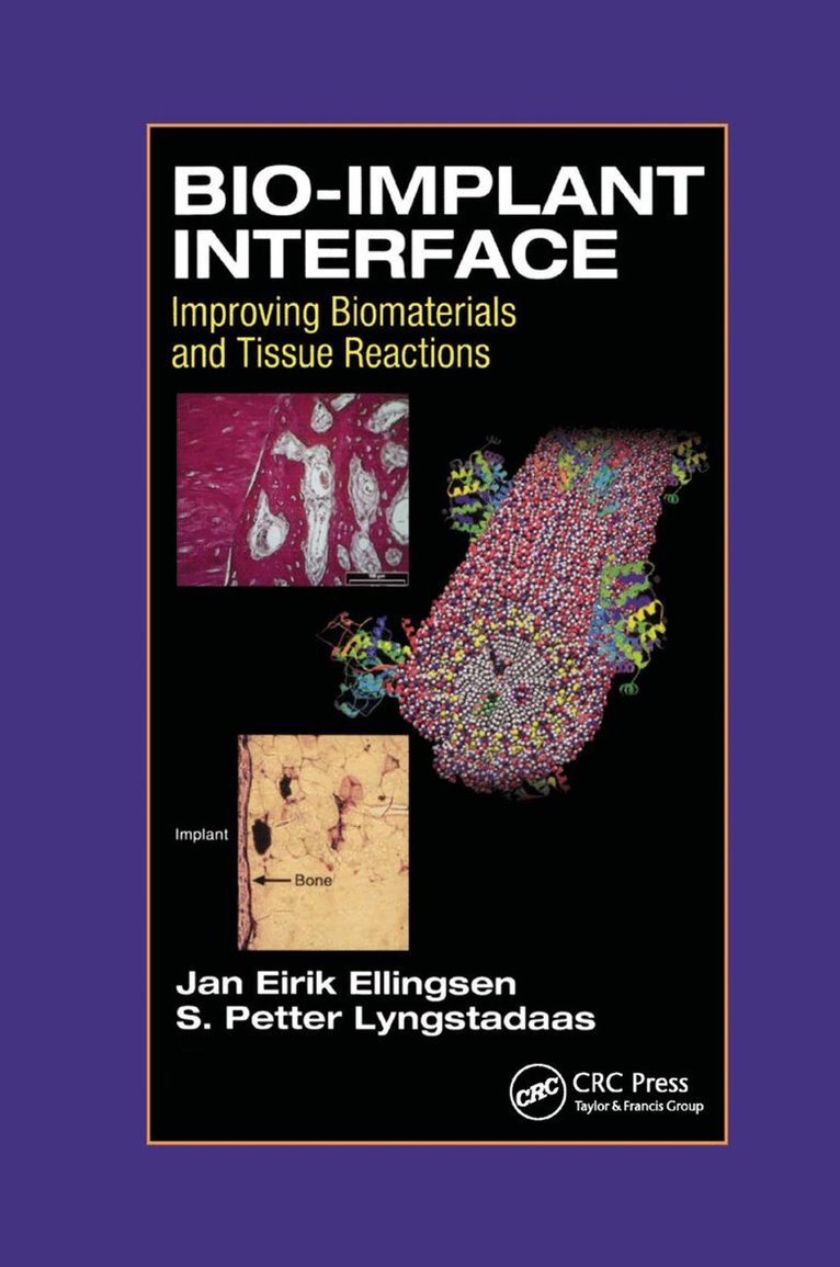 J.E. Ellingsen, S.P. Lyngstadaas - Bio-Implant Interface, Häftad