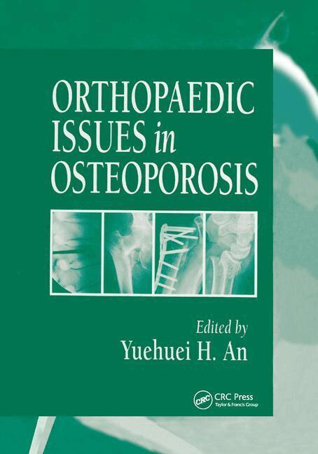 Yuehuei H. An - Orthopaedic Issues in Osteoporosis, Häftad. Tillgänglighet: Lägg i varukorg