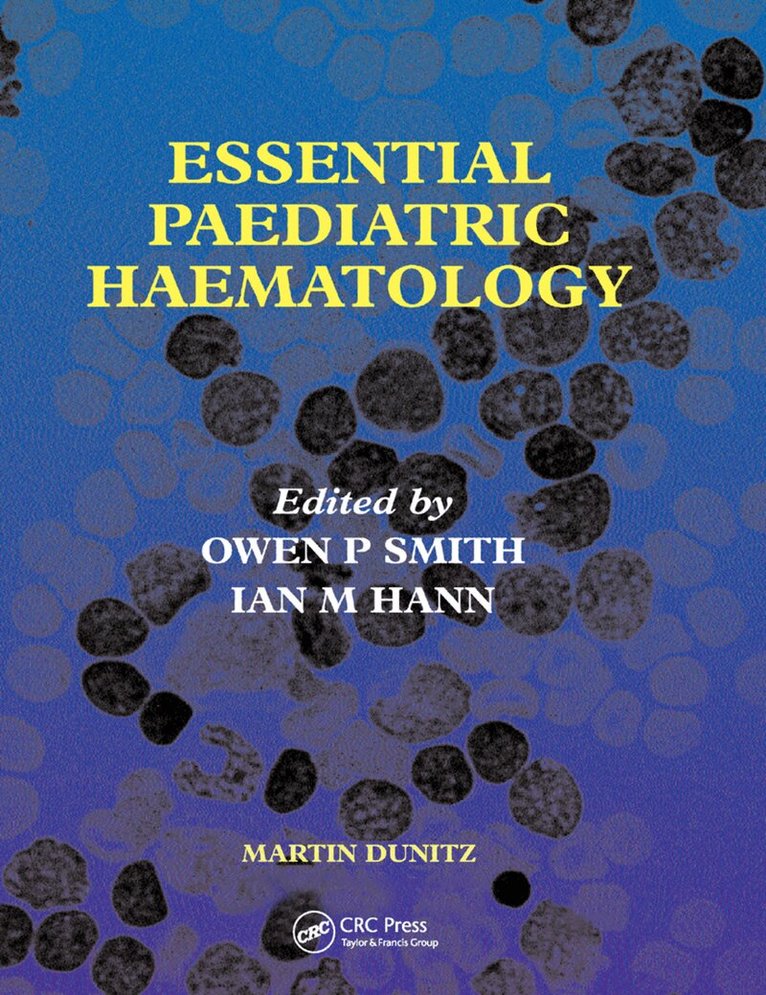Ian M. Hann, Owen P. Smith - Essential Paediatric Haematology, Häftad