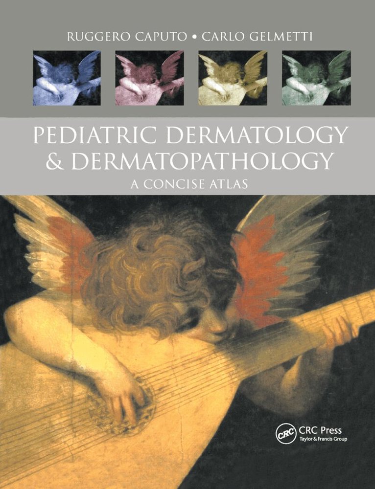 Ruggero Caputo, Carlo Gelmetti - Pediatric Dermatology and Dermatopathology, Häftad. Tillgänglighet: Tillfälligt slut
