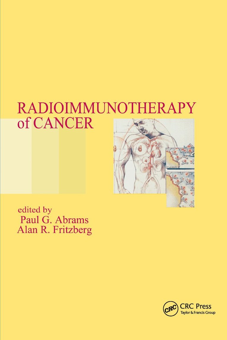Paul G. Abrams, Alan R. Fritzberg - Radioimmunotherapy of Cancer, Häftad. Tillgänglighet: Lägg i varukorg