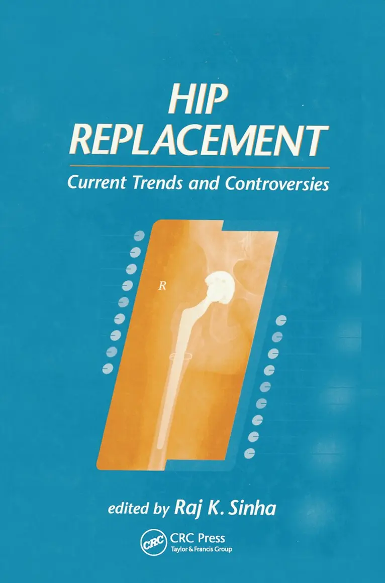 Raj K. Sinha - Hip Replacement, Häftad. Tillgänglighet: Lägg i varukorg