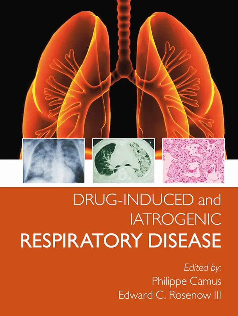 Phillipe Camus, Edward Rosenow III - Drug-induced and Iatrogenic Respiratory Disease, Häftad. Tillgänglighet: Tillfälligt slut