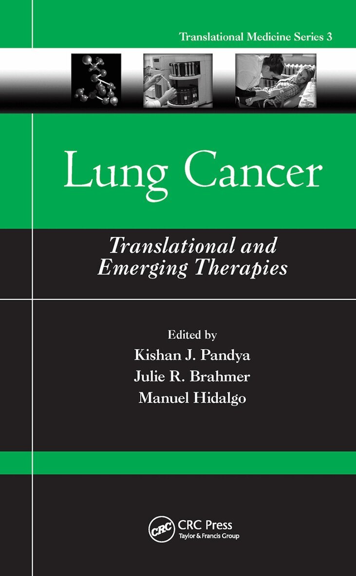 Kishan J. Pandya, Julie R. Brahmer, Manuel Hidalgo - Lung Cancer, Häftad. Tillgänglighet: Lägg i varukorg