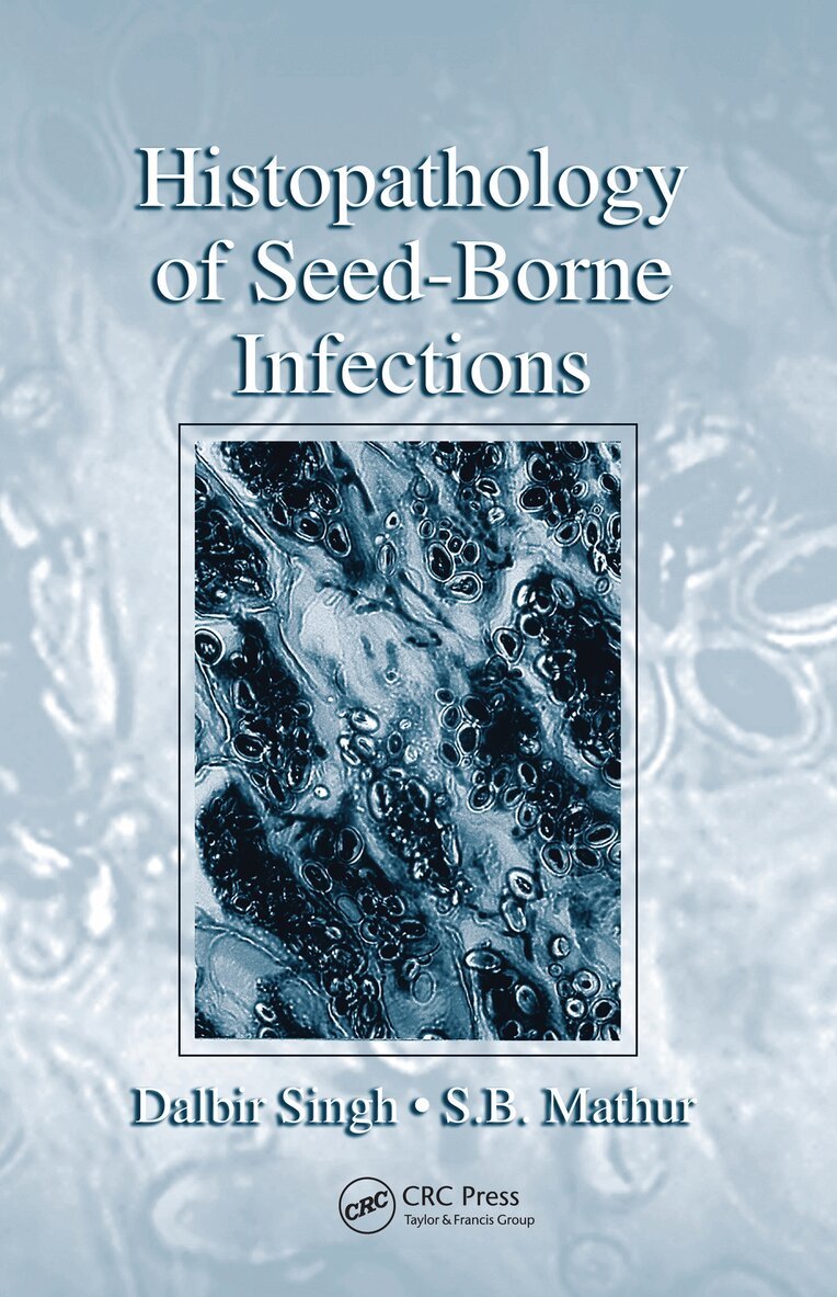 Dalbir Singh, S. B. Mathur - Histopathology of Seed-Borne Infections, Häftad. Tillgänglighet: Lägg i varukorg