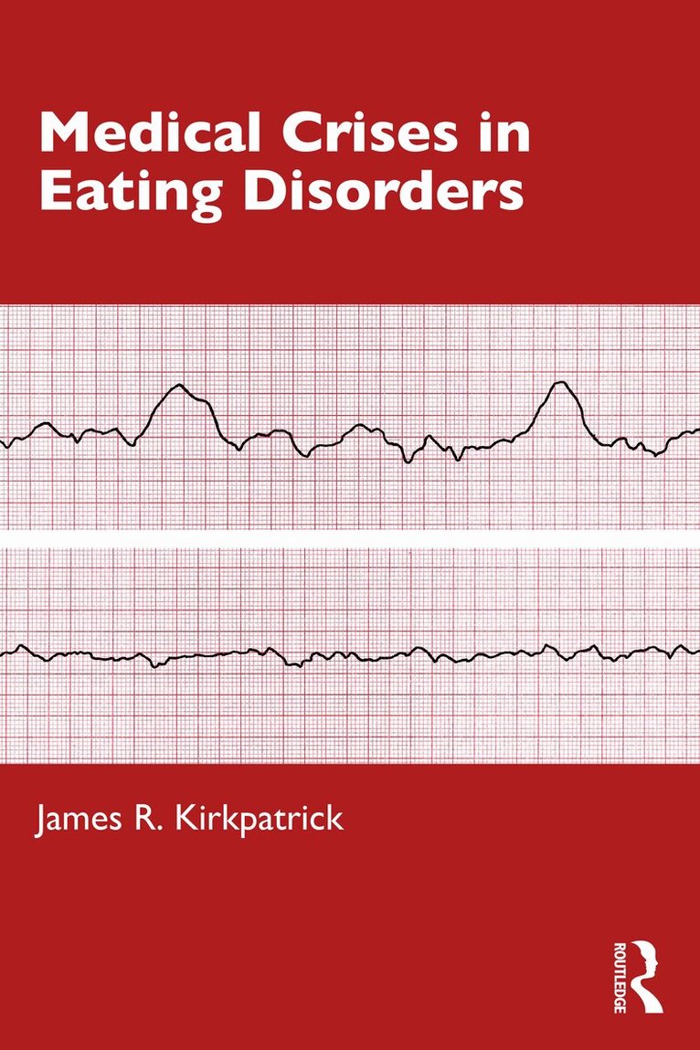 James R. Kirkpatrick - Medical Crises in Eating Disorders, Häftad. Tillgänglighet: Lägg i varukorg