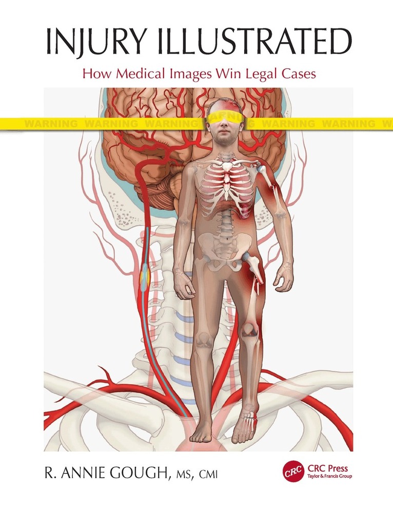 R. Annie Gough - Injury Illustrated, Inbunden. Tillgänglighet: Lägg i varukorg
