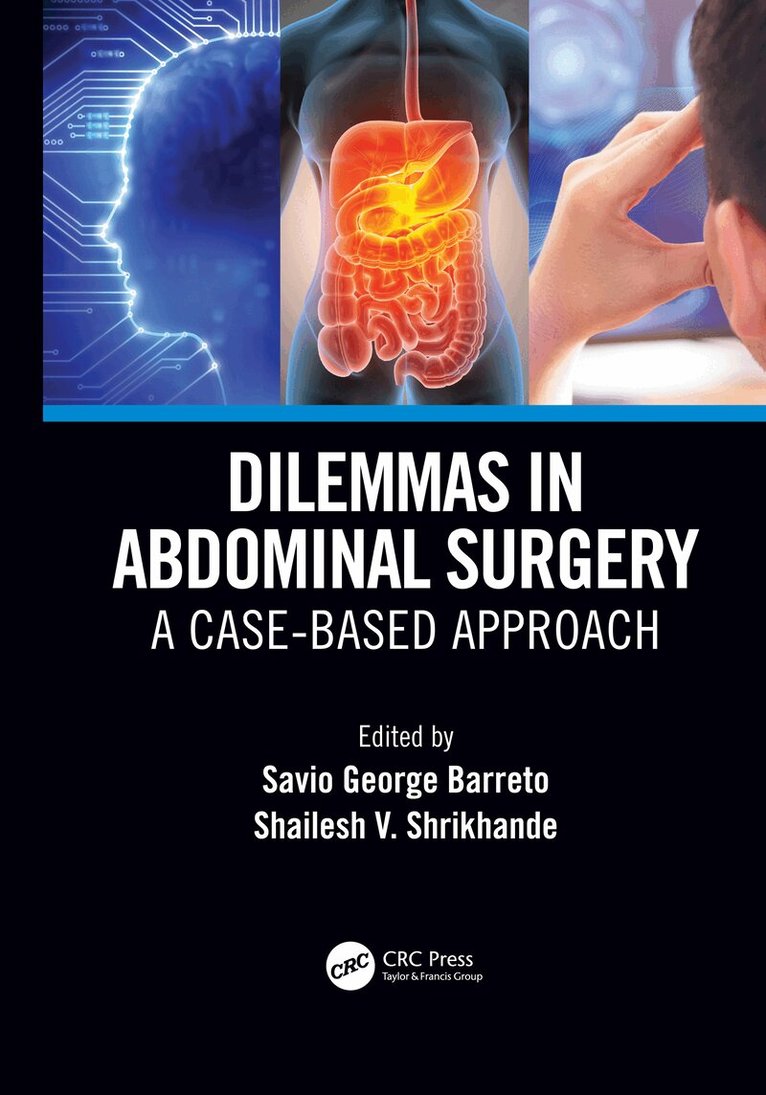 Savio George Alberto da Piedade Barreto, Shailesh Vinayak Shrikhande - Dilemmas in Abdominal Surgery, Inbunden