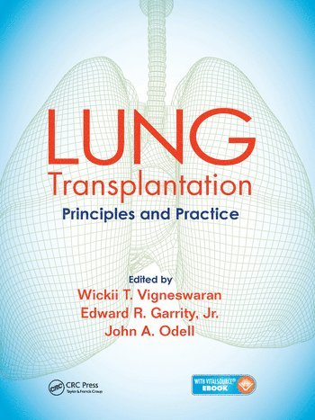 Lung Transplantation by Wickii Vigneswaran, Edward Garrity, John Odell