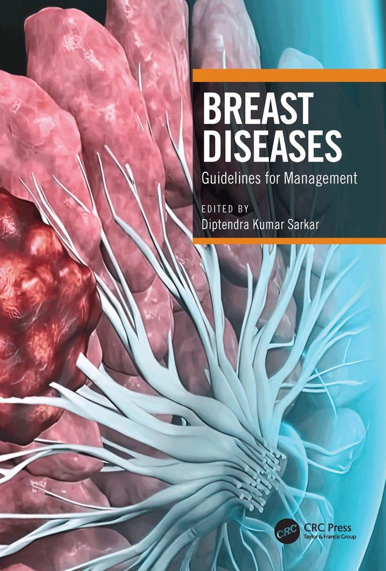 Diptendra Kumar Sarkar - Breast Diseases, Häftad