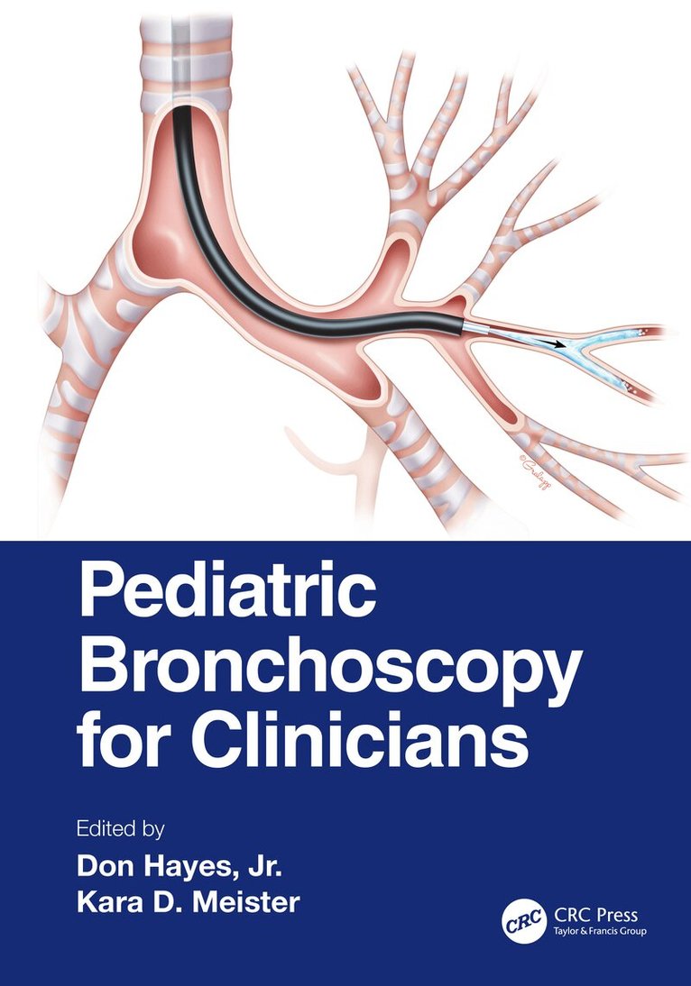 Don Hayes, Jr., Kara D. Meister - Pediatric Bronchoscopy for Clinicians, Häftad. Tillgänglighet: Lägg i varukorg