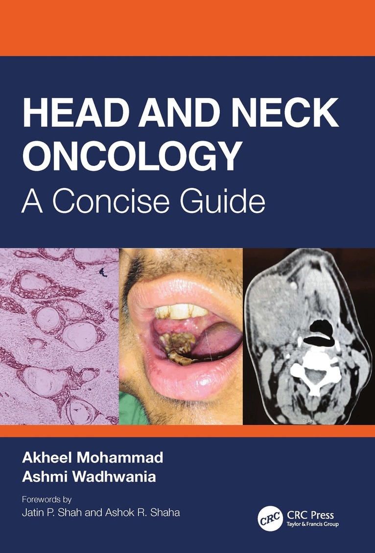 Akheel Mohammad, Ashmi Wadhwania - Head and Neck Oncology, Inbunden. Tillgänglighet: Lägg i varukorg