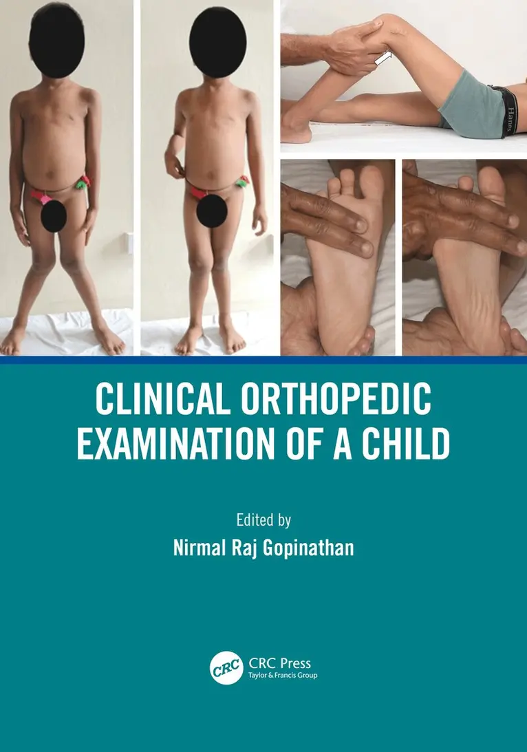 Nirmal Raj Gopinathan - Clinical Orthopedic Examination of a Child, Inbunden. Tillgänglighet: Lägg i varukorg