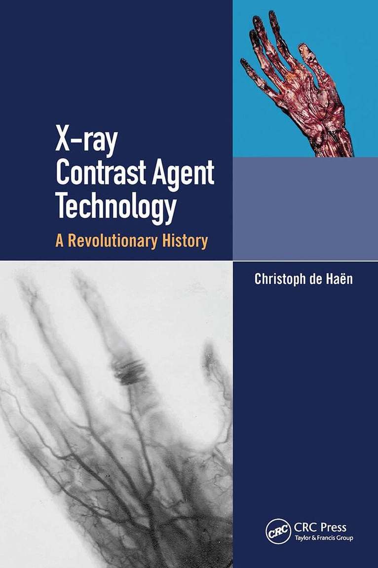 Christoph de Haen - X-ray Contrast Agent Technology, Häftad. Tillgänglighet: Lägg i varukorg