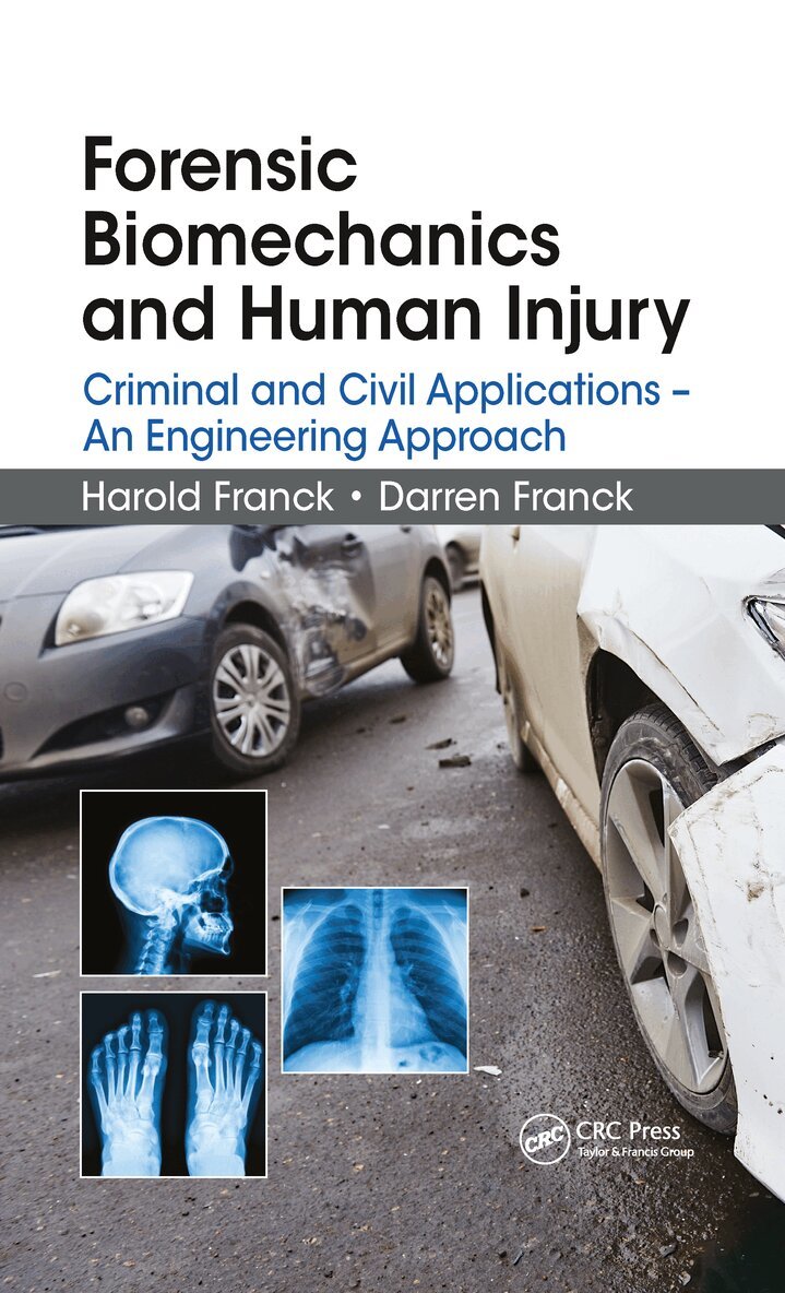 Harold Franck, Darren Franck - Forensic Biomechanics and Human Injury, Häftad. Tillgänglighet: Lägg i varukorg