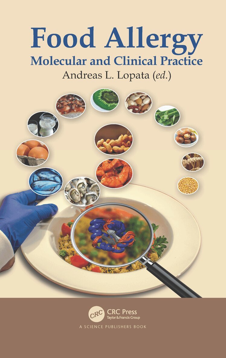 Andreas L. Lopata - Food Allergy, Häftad