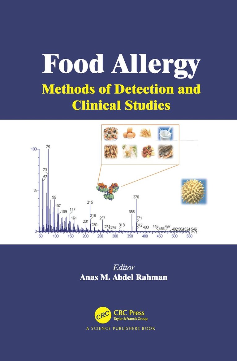 Anas M. Abdel Rahman - Food Allergy, Häftad