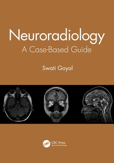 Neuroradiology by Swati Goyal, Swati Goyal