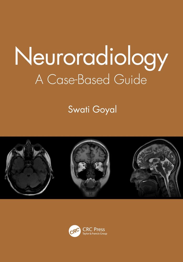 Swati Goyal - Neuroradiology, Häftad. Tillgänglighet: Lägg i varukorg