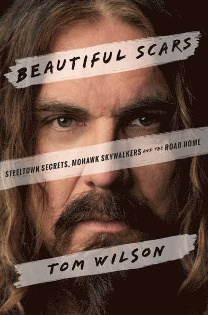 Tom Wilson - Beautiful Scars, E-bok