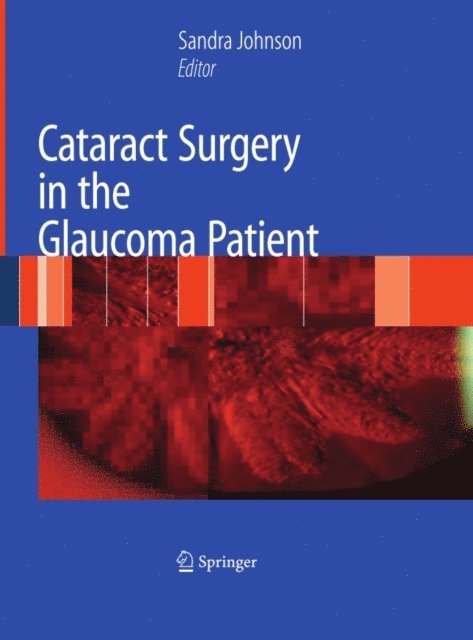 Sandra M. Johnson - Cataract Surgery in the Glaucoma Patient, E-bok