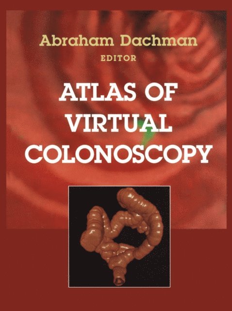 Abraham H. Dachman - Atlas of Virtual Colonoscopy, E-bok