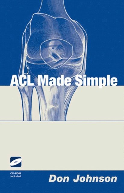 Don Johnson - ACL Made Simple, E-bok