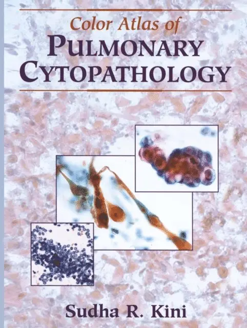 Sudha R. Kini - Color Atlas of Pulmonary Cytopathology, E-bok. Tillgänglighet: Lägg i varukorg
