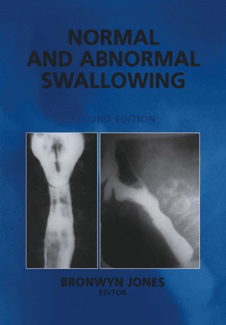 Bronwyn Jones - Normal and Abnormal Swallowing, E-bok