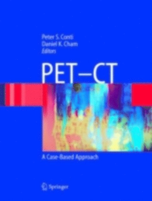 Daniel K. Cham, Peter S. Conti - PET-CT, E-bok