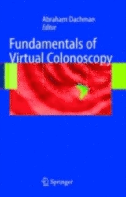 Abraham H. Dachman - Fundamentals of Virtual Colonoscopy, E-bok