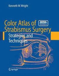 Color Atlas of Strabismus Surgery